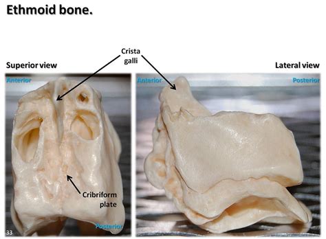 The ethmoid bone (from the greek ɛθmɔɪd meaning sieve) is an odd and median bone that, along with the frontal it is a light, spongy, irregular, odd bone and is located in the anterior part of the skull. Ethmoid bone, superior and lateral views with labels - Axi ...