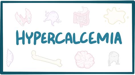 Hypercalcemia Causes Symptoms Diagnosis Treatment Pathology Youtube
