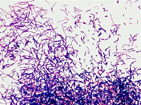 Photograph Gram Positive Bacteria Bacilli Science Source Images