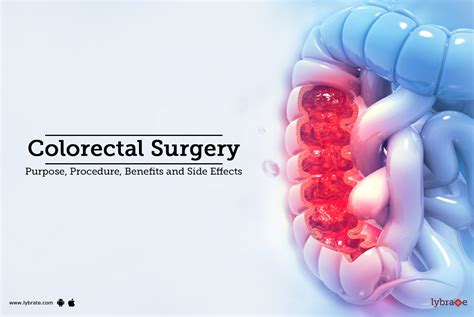 Colorectal Surgery Purpose Procedure And Benefits And Side Effects