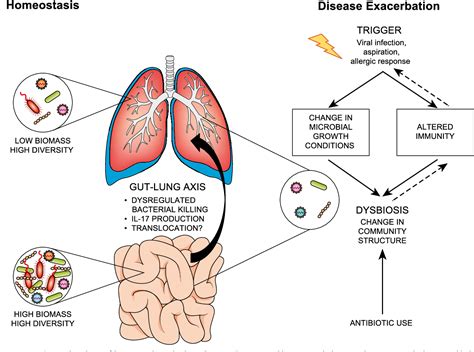 Figure 1 From The Lung Microbiome Immunity And The Pathogenesis Of