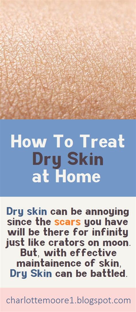 How To Treat Dry Skin At Home Charlotte Moore