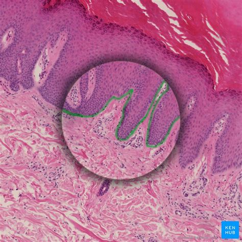 Depending on the type of epidermolysis bullosa, blistering may occur in the top layer of skin (epidermis), the bottom layer (dermis) or the layer that separates the two (basement membrane zone). Skin: Cells, layers and histological features | Kenhub