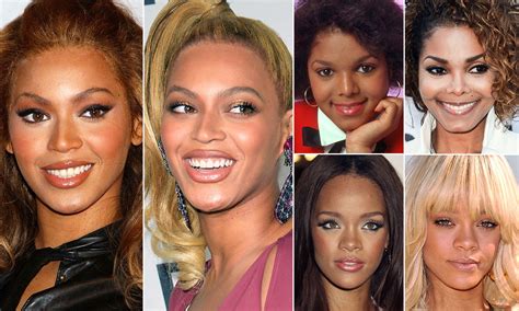Beyonce Before And After Bleaching Her Skin Naturalskins