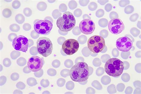 Polymorphonuclear Leukocytes White Blood Cells