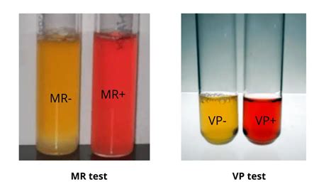 Methyl Red Mr Test Principle Procedure Results Uses