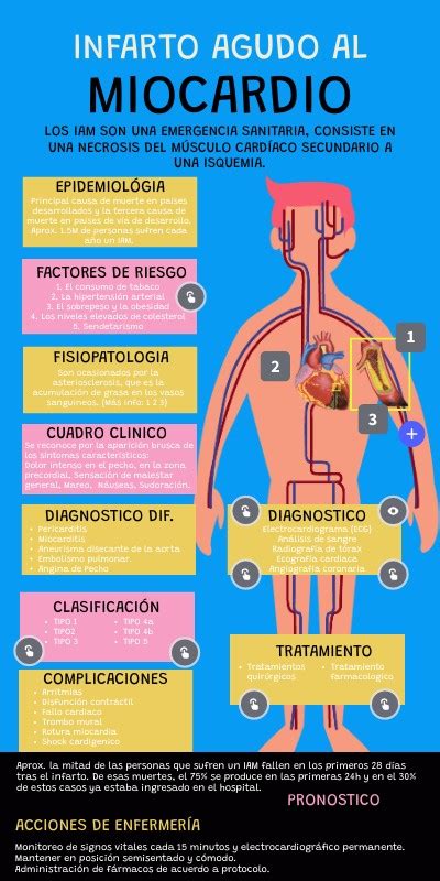 Infarto Agudo Al Miocardio