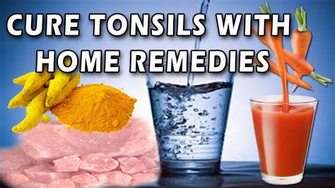 Cure Tonsils With Home Remedies Ii टॉन्सिल का घरेलू उपचार Ii Youtube