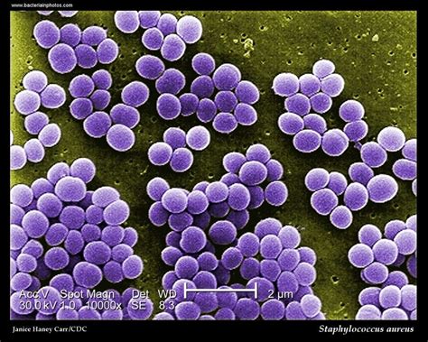 Staphylococcus aureus bacteria are pathogens to both man and other mammals. Pin on Under the Microscope