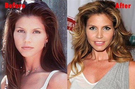 Charisma cappelli 2 14 torrents for free, downloads via magnet also available in listed torrents detail page, torrentdownloads.me have largest bittorrent database. Charisma Carpenter Plastic Surgery Before and After