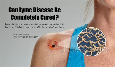 Asthma is a chronic disease that cannot be cured. Can Lyme Disease Be Completely Cured?