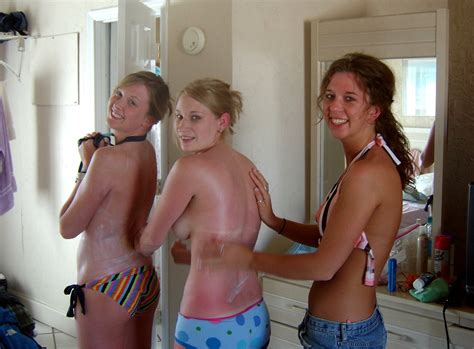 Do You Have Sunburn Or Are You Always This Hot Porn Pic Eporner