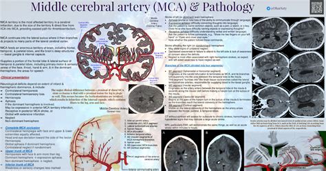 Middle Cerebral Artery MCA Territory CVA Medical Infographics
