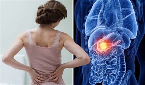 Pancreatic Cancer Symptoms Pain Commonly Shows Up In Your Back And
