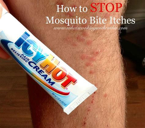 Natural Remedies For Mosquito Bite Itches
