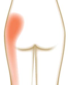 3 Types Of Pain In The Butt And What You Can Do About It