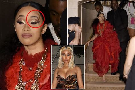 Cardi B Spotted With A Huge Lump Above Her Eye After Scuffle With Nicki Minaj Mirror Online