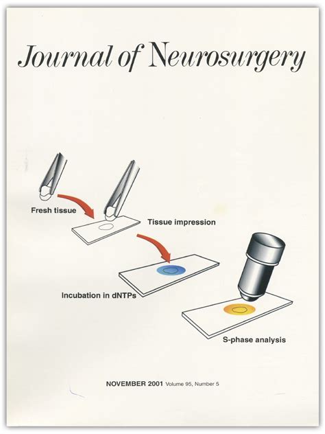 Expression of matrix metalloproteinases 2 and 9 in meningiomas