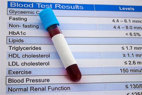 Making Sense Of Cholesterol Tests Harvard Health