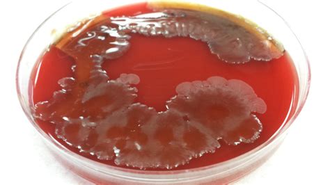 Gram Positive Encapsulated Rods From Blood Agar