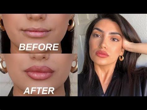 How To Get Big Lips Naturally Without Lip Fillers Or Surgery Get Full