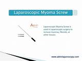 Laparoscopic Hysterectomy Recovery Tips