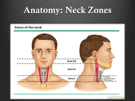 Zones Of Neck Anatomy