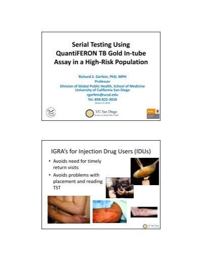 Serial Testing Using Quantiferon Tb Gold In Tube Assay In A High