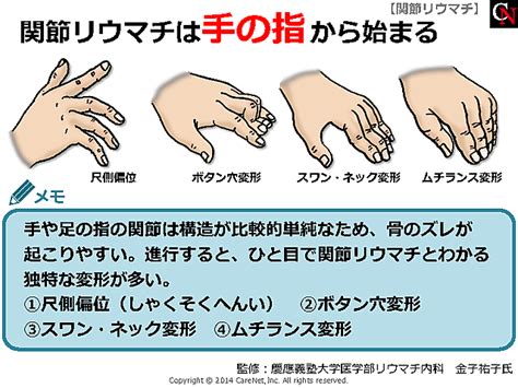 CareNet.com へようこそ｜医師・医療従事者向け医学情報・医療 ...