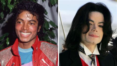 ¿por Qué La Piel De Michael Jackson Se Volvió Blanca Salud180