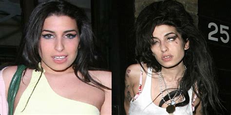 Amy Winehouse The Before And After Of Drugs And Alcohol Newz
