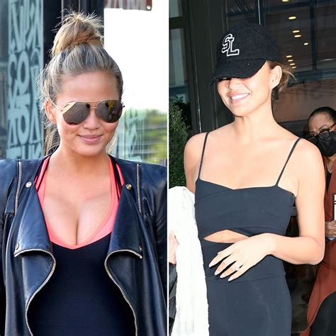 Celebs Who Had Breast Implants Removed Before After Photos