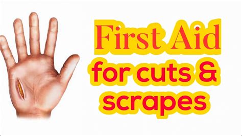How To Treat Cuts And Scrapes First Aid Training Youtube