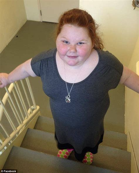 Obese Texas Girl Alexis Shapiro Loses 6lbs And Off Insulin After Gastric Surgery Daily Mail Online