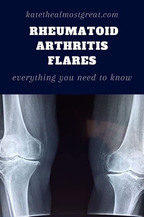 Beginners Guide Rheumatoid Arthritis Flare Up Kate The Almost
