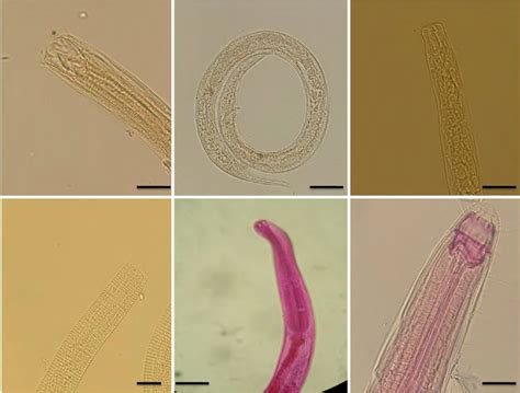Distinguishing Morphological Features Of Nematode Species From The