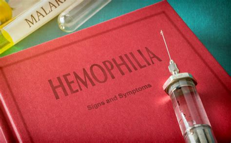 8 Natural Remedies To Manage Hemophilia