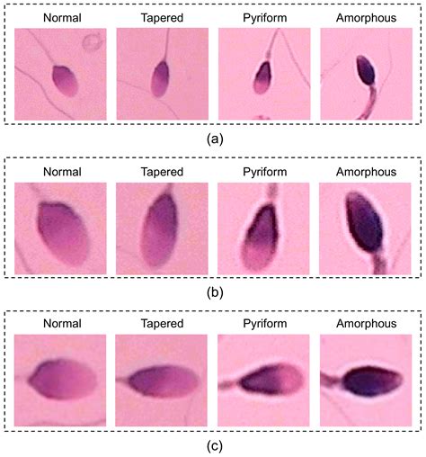 Applied Sciences Free Full Text Automatic Microscopy Analysis With Transfer Learning For