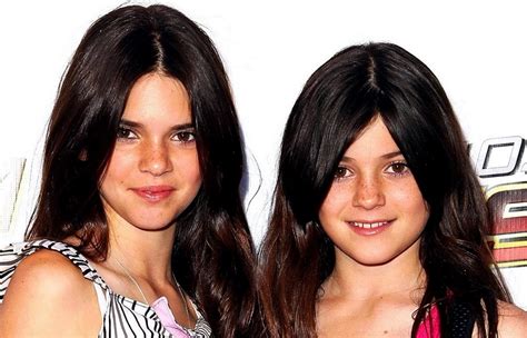 Kendall Jenner Before And After Plastic Surgery