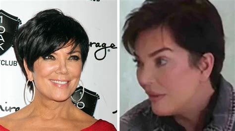 Kris Jenner S Facial Transformation Sparks Frenzy