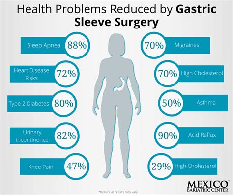 Mexico Bariatric Center Health Problems Reduced By Gastric Sleeve