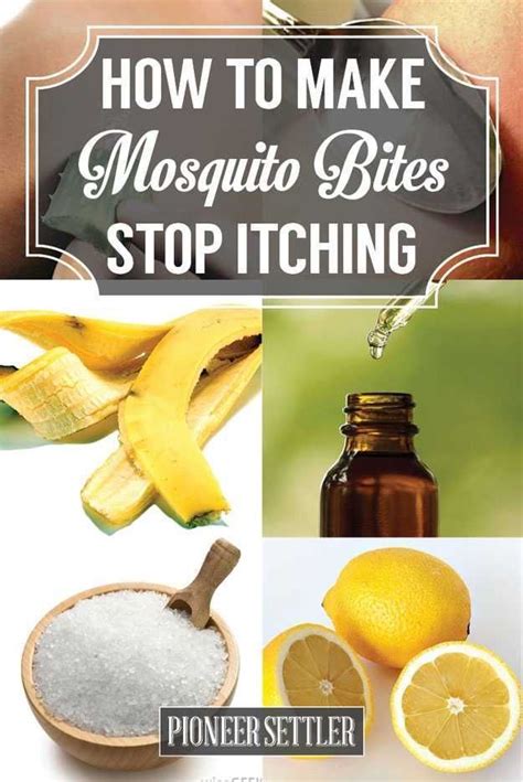 15 Home Remedies For Mosquito Bites That Itch Homesteading Remedies