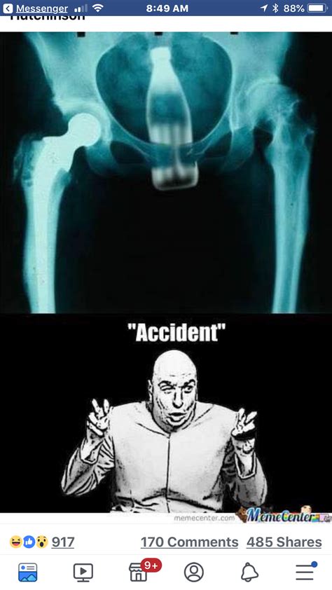 Radiology Humor Funny X Ray Memes