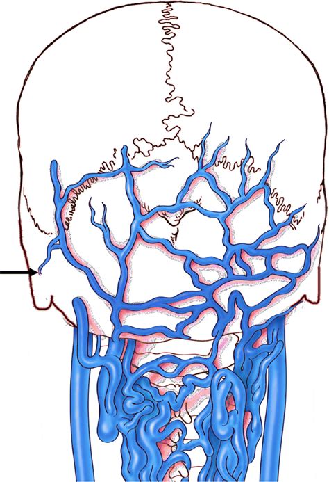 Schematic Drawing Of The Posterior Skull And Associated Veins Note The