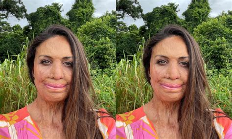 What Skills And Attributes Does Turia Pitt Display That Enhances Her Resilience In The Face Of