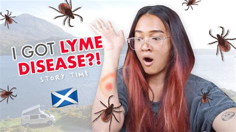 How I Got Lyme Disease In The Scottish Highlands Not Clickbait