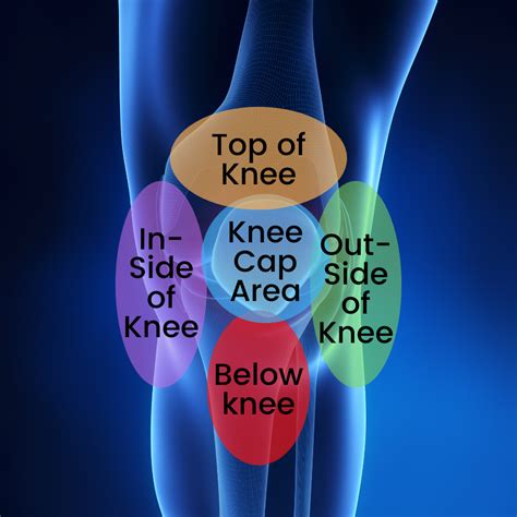 What Could Be Causing Your Knee Pain