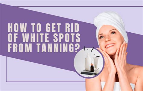 How To Get Rid Of White Spots From Tanning Spots Reason And Treatment