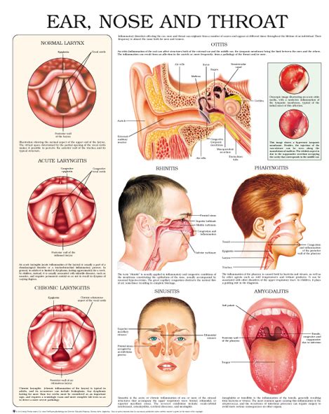 Ear Nose And Throat Anejo