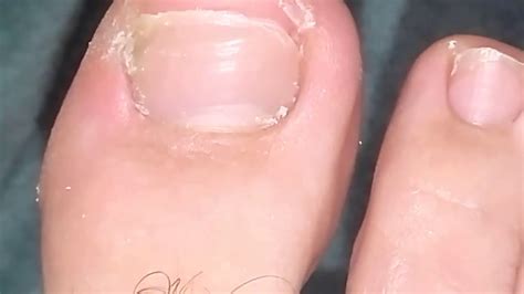 Cutting And Cleaning Toenail Routine Toe Care Youtube
